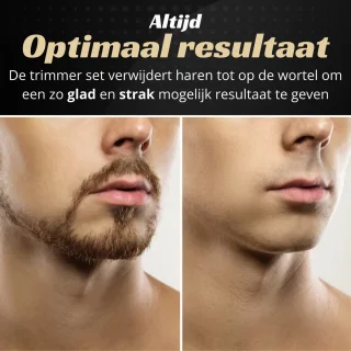 Modito 5-in-1 Baardtrimmer Scheerapparaat Bodygroomer Zwart/Goud