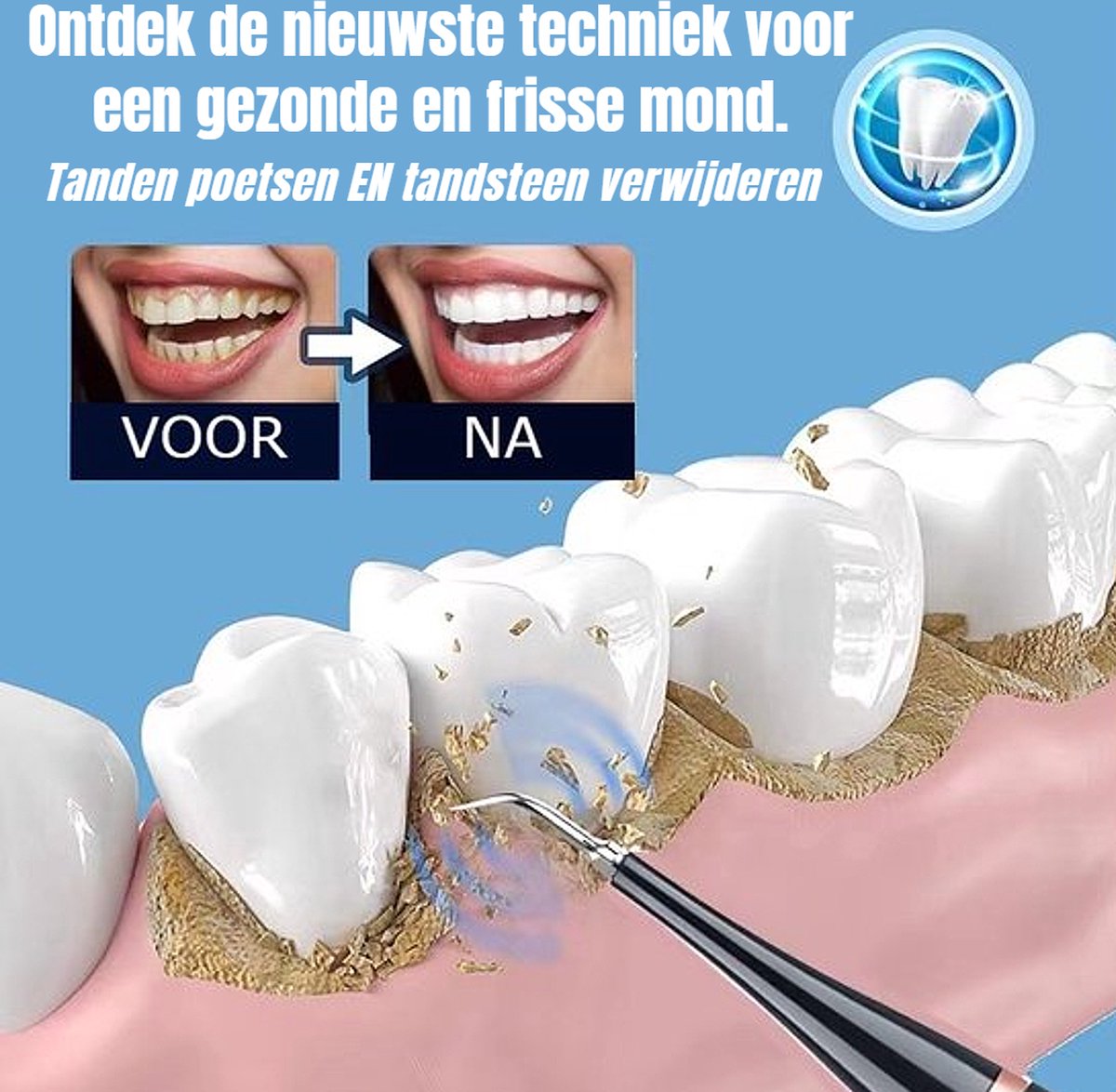 Allernieuwste.nl® Sonische Tandenborstel Plus Wit Set