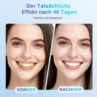 Automatische ultrasone tandenborstel - ShopVlot