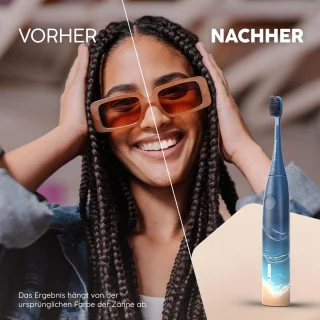 Elektrische Sonic-tandenborstel Blauw