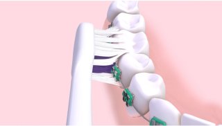 GUM Sonic Ortho Elektrische Tandenborstel