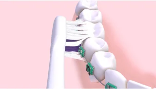 GUM Sonic Ortho Elektrische Tandenborstel