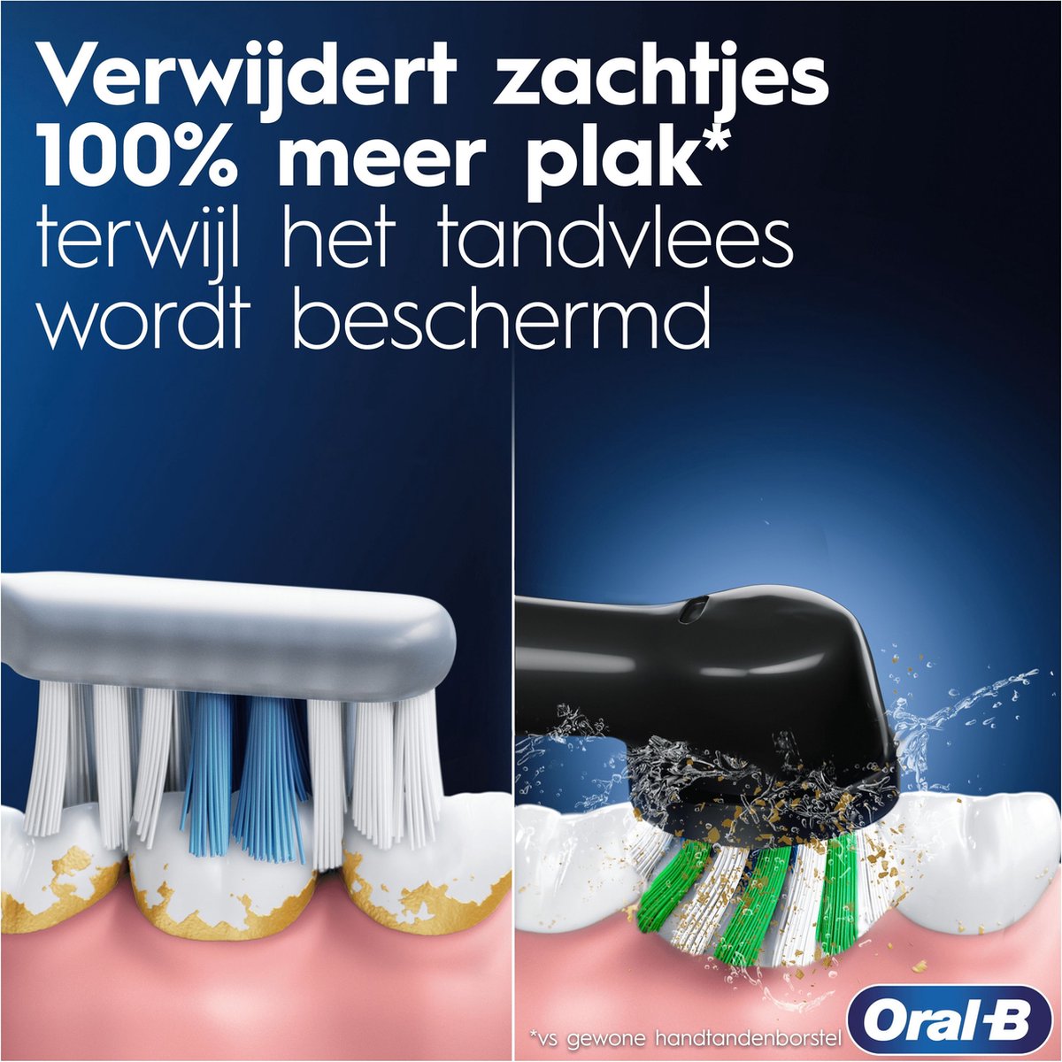 Oral-B Pro Series 1 Elektrische Tandenborstel Blauw/Zwart