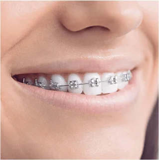 Oral-B Smartseries Teen Elektrische Tandenborstel Wit
