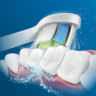 Philips Sonicare ProtectiveClean 4300 HX6800/35 elektrische tandenborstel roze zwart