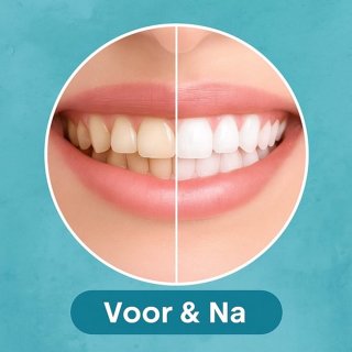 Wat vinden we minder goed