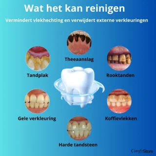 SmilePro Elektrische Tandenborstel Polijstset