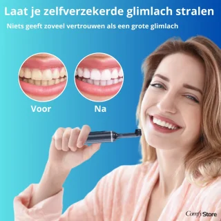 SmilePro Elektrische Tandenborstel Polijstset
