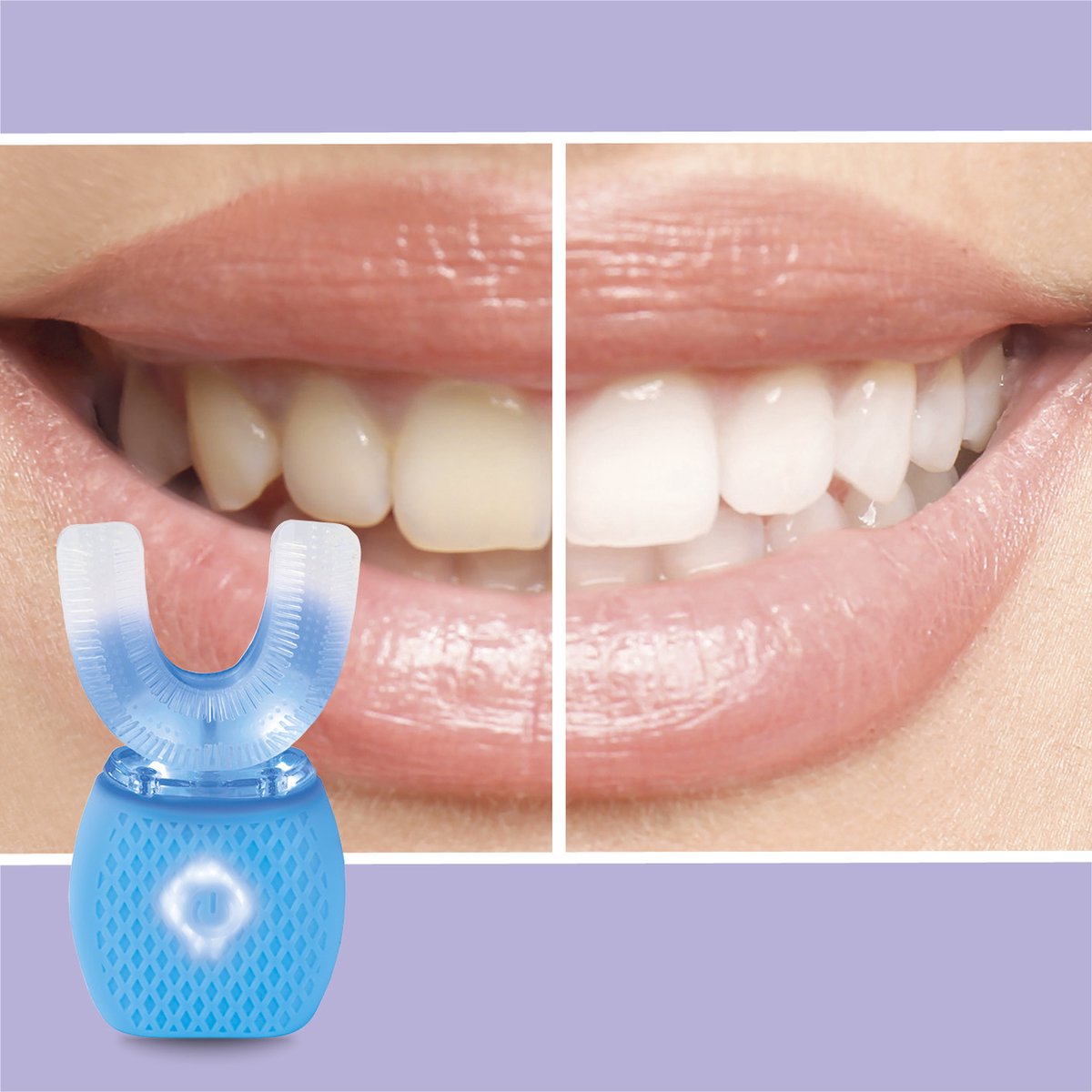 VITALmaxx 360° sonische tandenborstel wit/turquoise