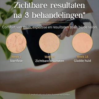 VasQura NUDA IPL Laser Ontharingsapparaat – Luxe Set - Inclusief Opzetstukken Huidverjonging & Acne-vermindering - 2025 – IPL ontharingsapparaat – Jarenlang gebruik – Zwart