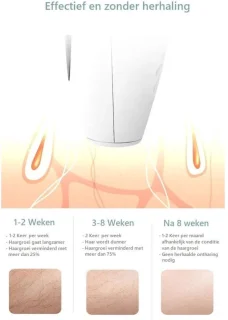 MKSS® Laser Ontharingsapparaat - IPL Ontharing - Mannen & Vrouwen - Wit