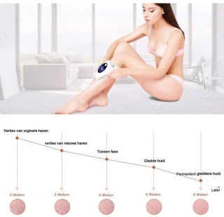 MKSS® Laser Ontharingsapparaat - IPL Ontharing - Mannen & Vrouwen - Wit