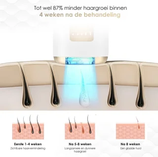 VENEUX® Laser Ontharingsapparaat - Ontharingsapparaten - Ontharing - IPL - Wit