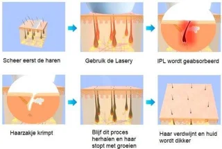 2-in-1 Lichtontharingsapparaat – IPL - Quartz Lamp - 700.000 Flitsen - Permanente Haarverwijdering - Laser ontharingsapparaat - Permanente Haarverwijdering