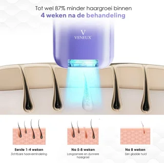 VENEUX® Laser Ontharingsapparaat - Ontharingsapparaten - Ontharing - IPL - Paars
