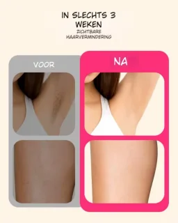 Nawy® IPL Laser Ontharingsapparaat - Epileerapparaat Dames - Laser Ontharing - Pijnloos Ontharen met Ice Cooling - Permanente Ontharing voor alle Lichaamsdelen - voor Mannen en Vrouwen - 990.000 Flitsen - Inclusief Beschermbril en Scheermes