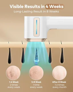 Namajunas - Laser Ontharingsapparaat - IPL ontharingsapparaten - 9 intelligente energieniveau-aanpassingen - Pijnloze ontharing - Wit - Epileerapparaat Dames - Inclusief Beschermbril & Scheermes - Voor lichaam, gezicht, bikinilijn & oksels