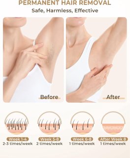 Wat vinden we goed aan de Laser Ontharingsapparaat - Laser Ontharing - Ontharingslaser - Ontharen voor Thuis - Epilator - Epileerapparaat