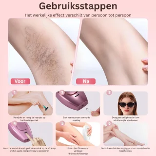 Laser Ontharingsapparaat - IPL Ontharing - Mannen & Vrouwen - Wit