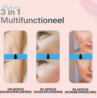 Apeiron Laser IPL Ontharingsapparaat