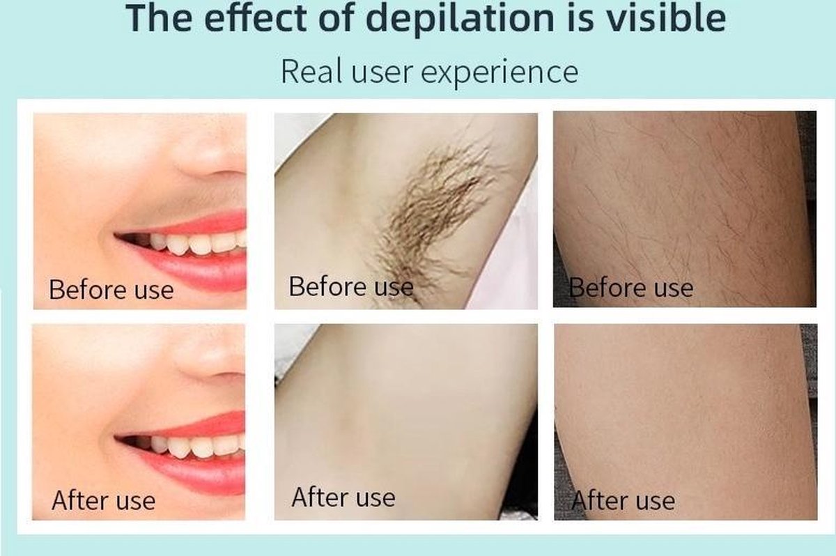 Aruvaya Premium IPL Laser Ontharingsapparaat