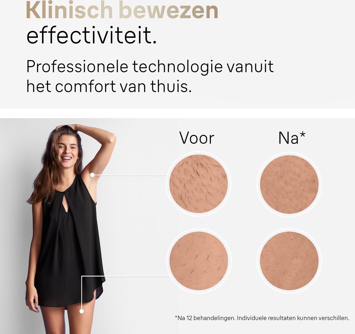 Advies voor kopers