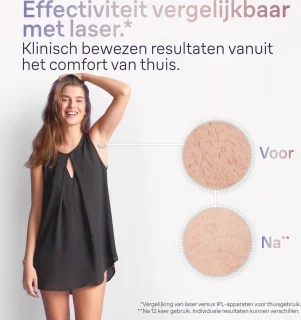 Braun Smart PL7253 IPL Ontharingsapparaat