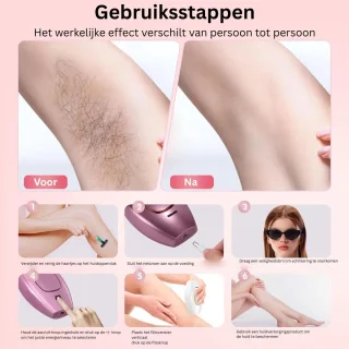 CLGP® IPL Laser Ontharingsapparaat