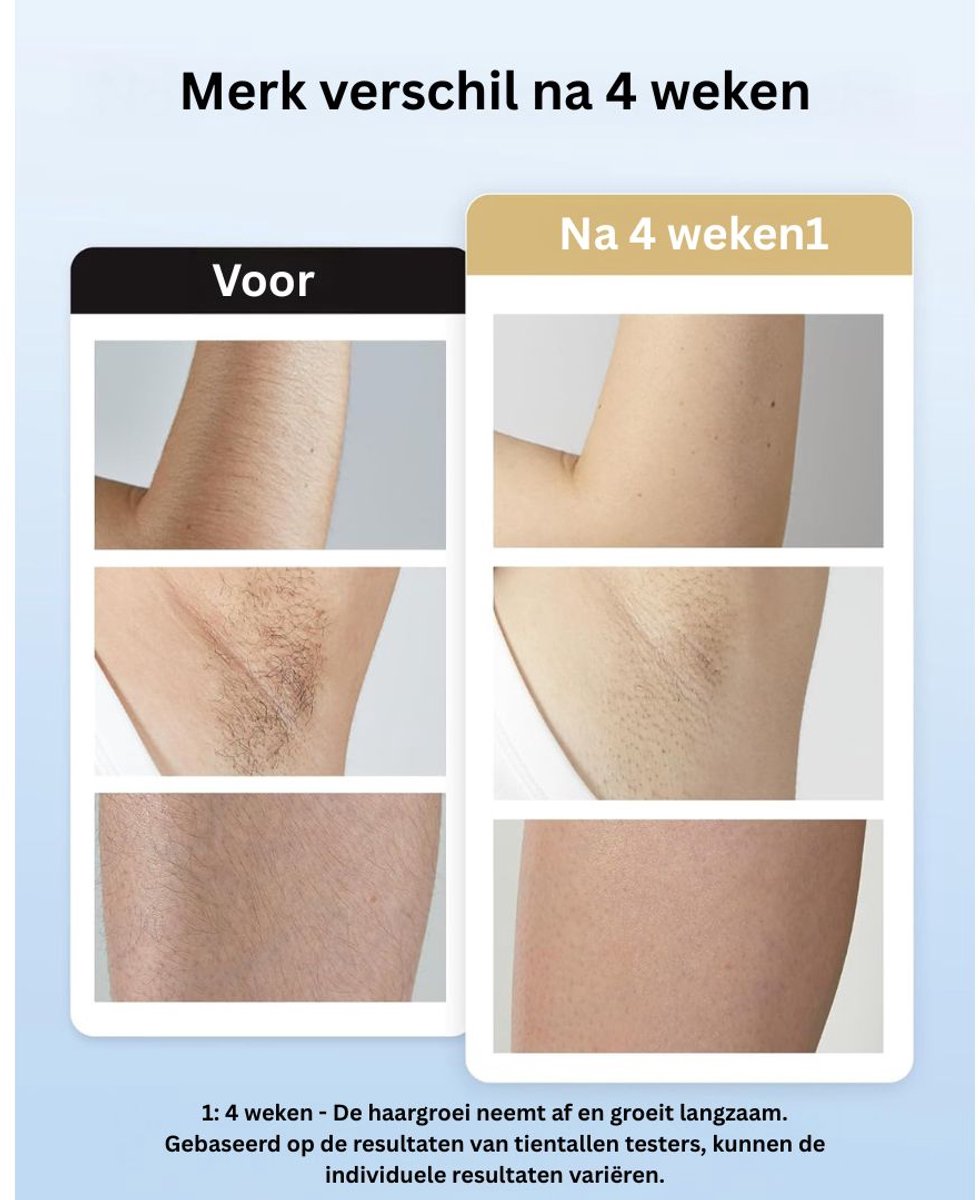 CLGP Laser IPL Ontharingsapparaat Rozegoud
