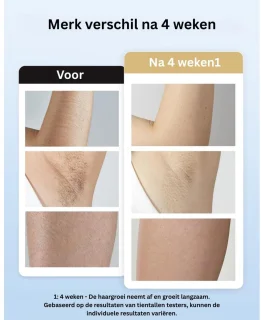 CLGP Laser IPL Ontharingsapparaat Rozegoud