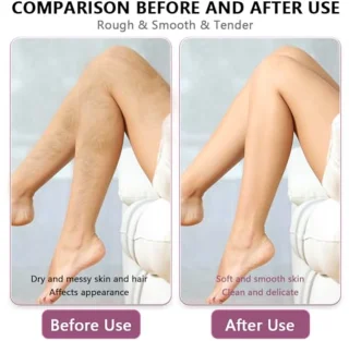 Crystal Nano-epilator