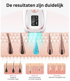 DailySupplies Laser Ontharingsapparaat IPL - Mannen & Vrouwen