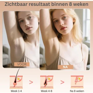 DailySupplies Laser Ontharingsapparaat IPL voor Mannen en Vrouwen
