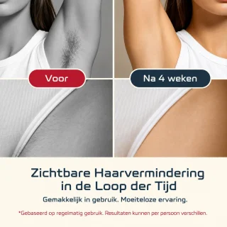 Wat vinden we goed aan de DEKI LUMA IPL Ontharingsapparaat