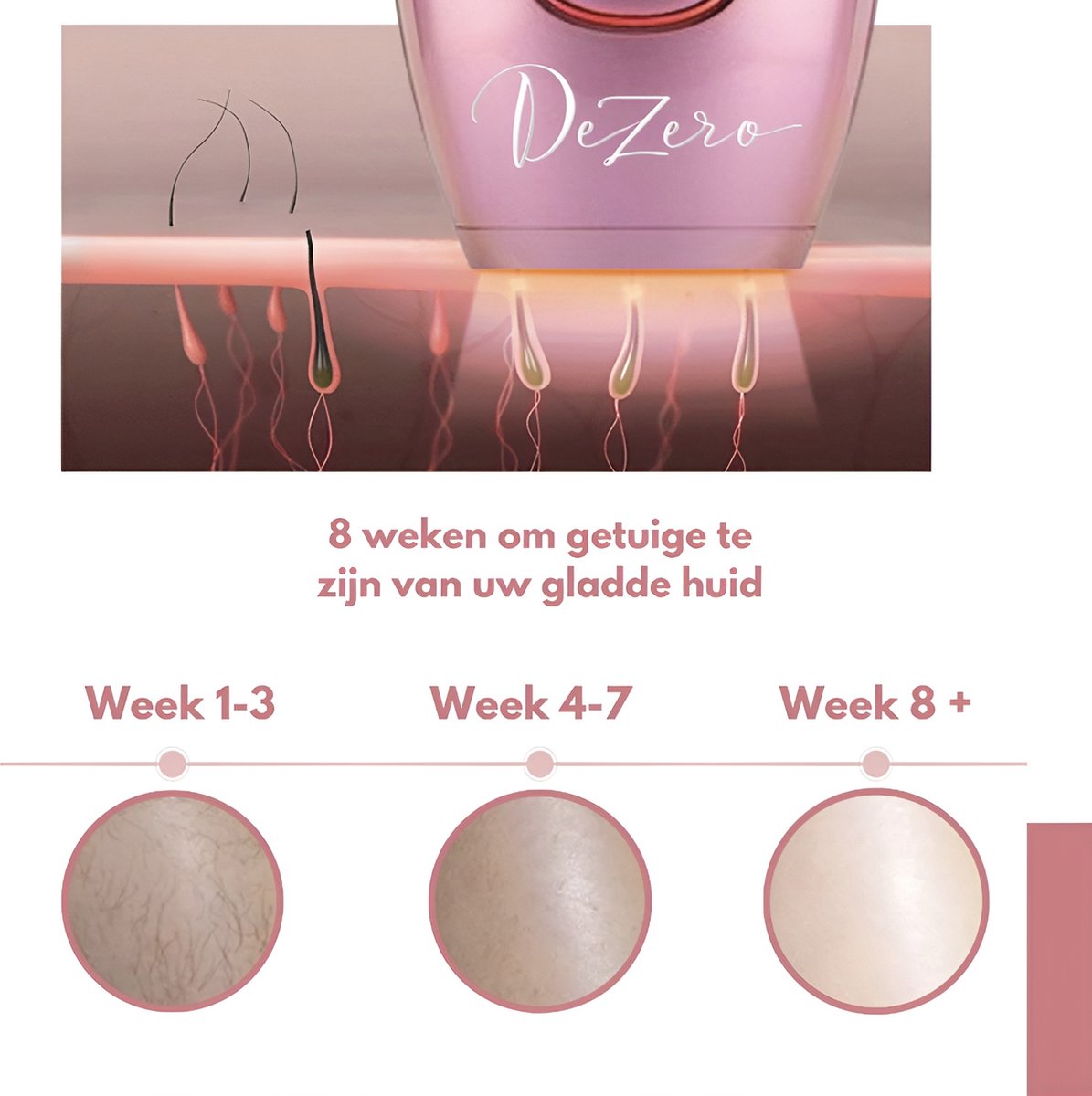 Dezero® IPL Laser Ontharingsapparaat Home Set