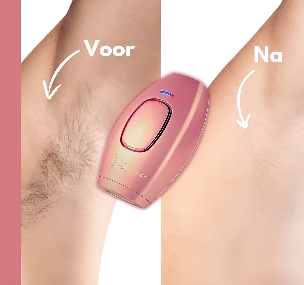 Dezero® IPL Laser Ontharingsapparaat Home Set