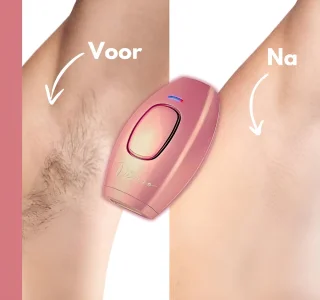 Dezero® IPL Laser Ontharingsapparaat Home Set