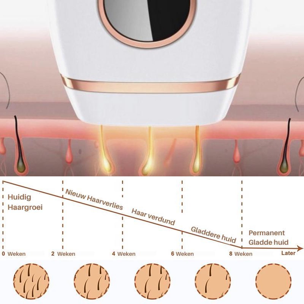 Dyla IPL Hair Removal Ontharingsapparaat Wit