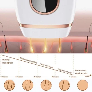 Dyla IPL Hair Removal Ontharingsapparaat Wit