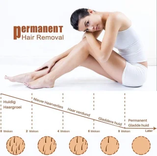 Dyla IPL Ontharingsapparaat Hair Removal Zwart