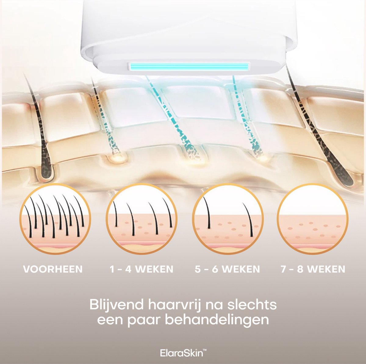 ElaraSkin IPL laser ontharingsapparaat