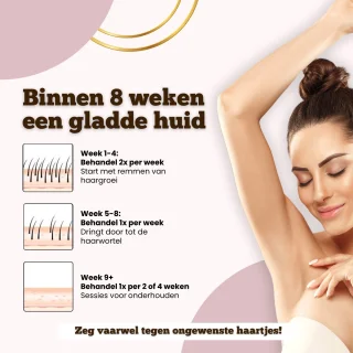 ElegantSkin IPL Ultra Draadloos Laser Ontharingsapparaat