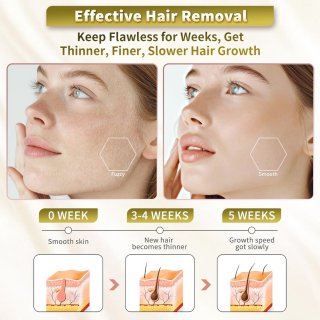 Wat vinden we goed aan de Epilator voor gezicht en lichaam