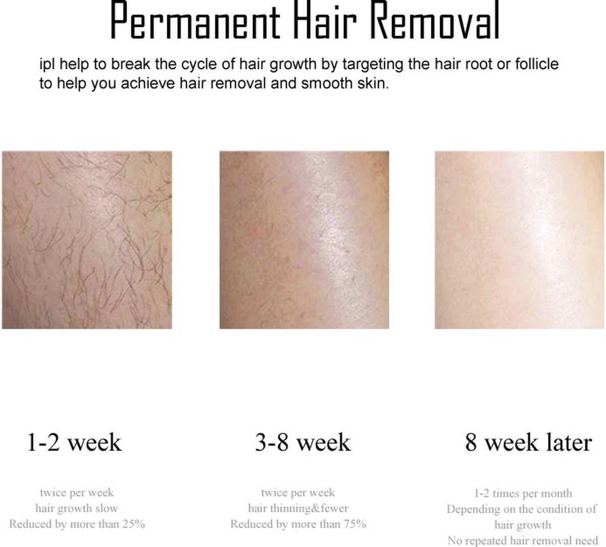 Eszenzics™ Laser ontharingsapparaat Premium IPL Wit