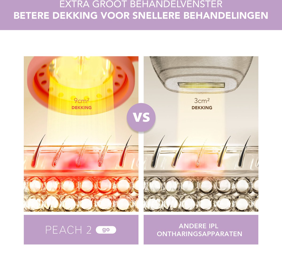 FOREO PEACH 2 go IPL ontharingstool