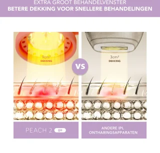 FOREO PEACH 2 go IPL ontharingstool