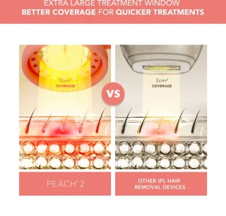 FOREO PEACH 2 IPL ontharingsapparaat