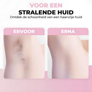 GoGoldPro IPL Ontharingsapparaat - Roze