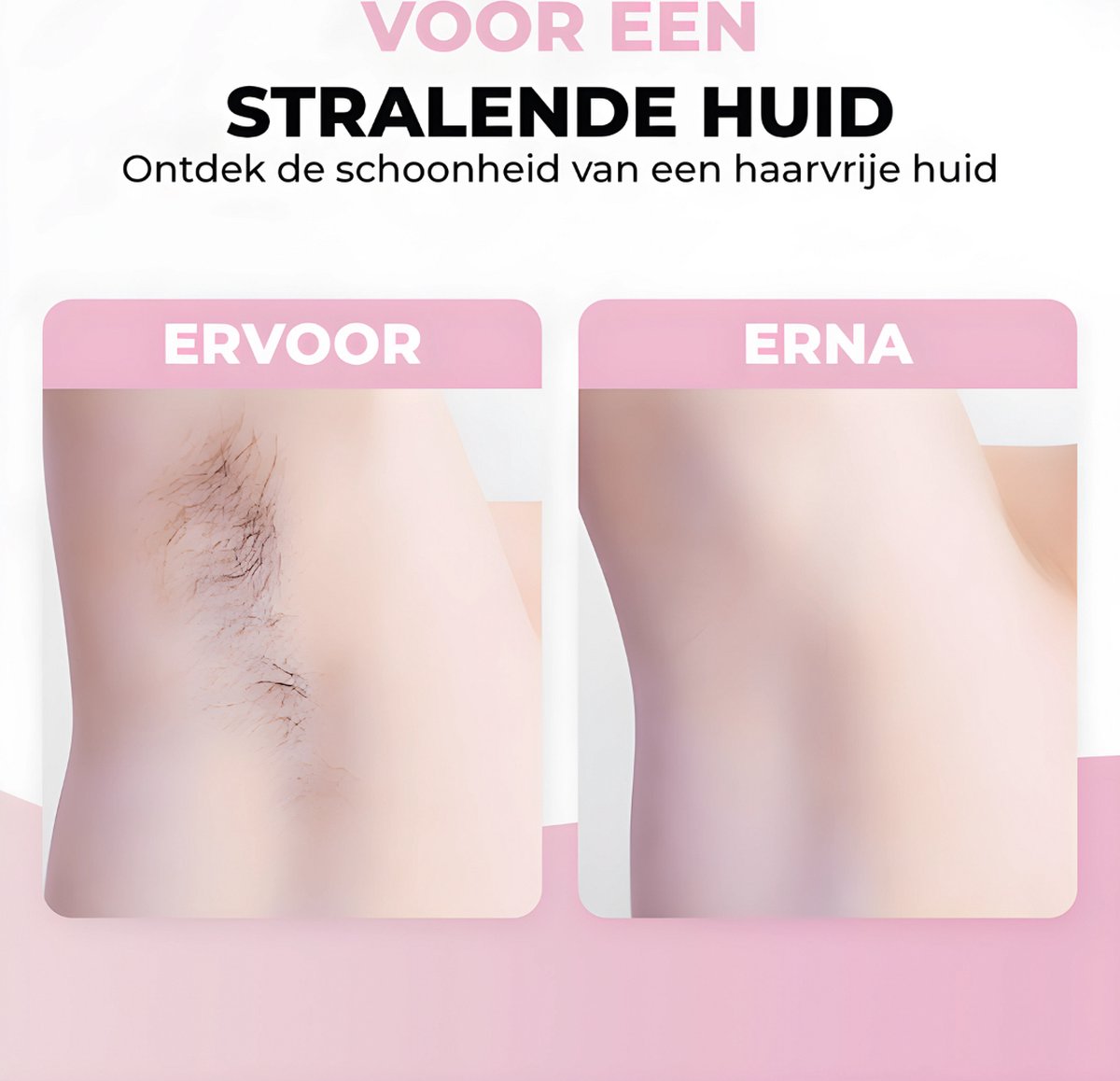 GoGoldPro IPL Ontharingsapparaat Zwart Wit Roze