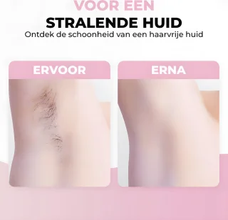GoGoldPro IPL Ontharingsapparaat Zwart Wit Roze